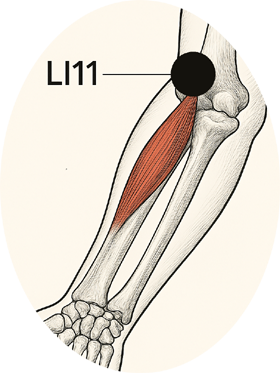 Akupunktur - Tennisellenbogen